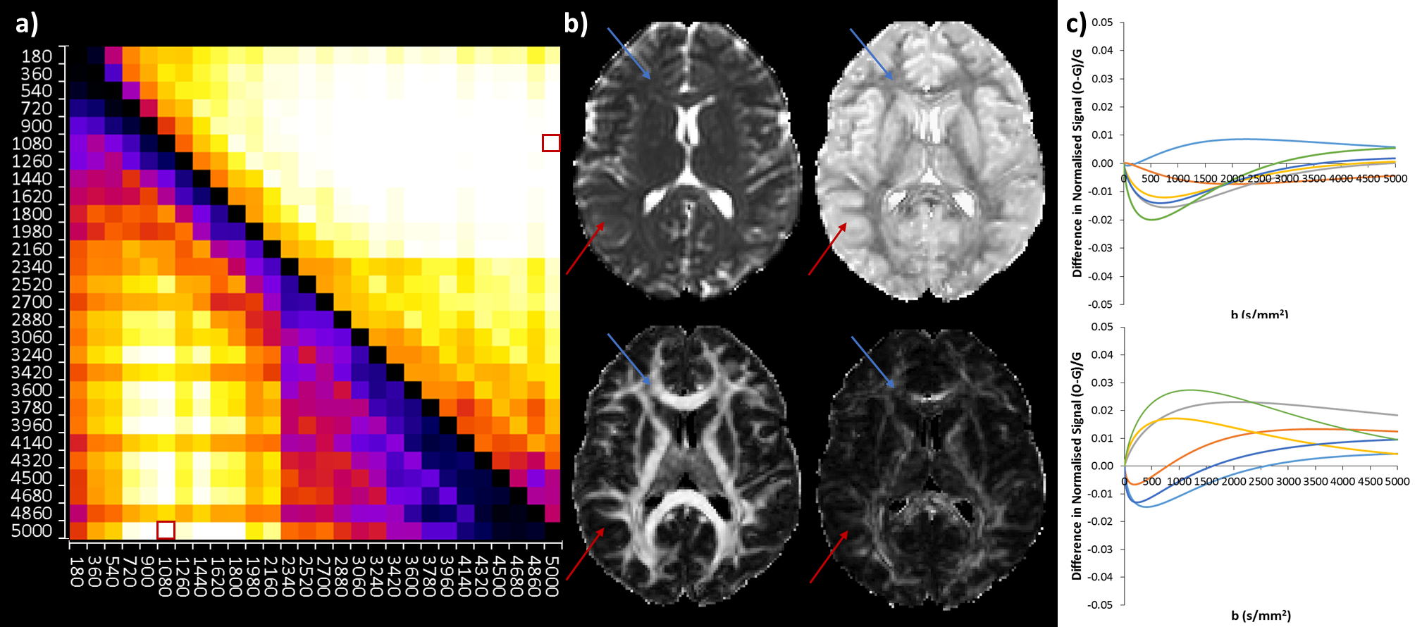 Quasi-diffusion Image (QDI) Is Anew High B-value MRI Technique ...