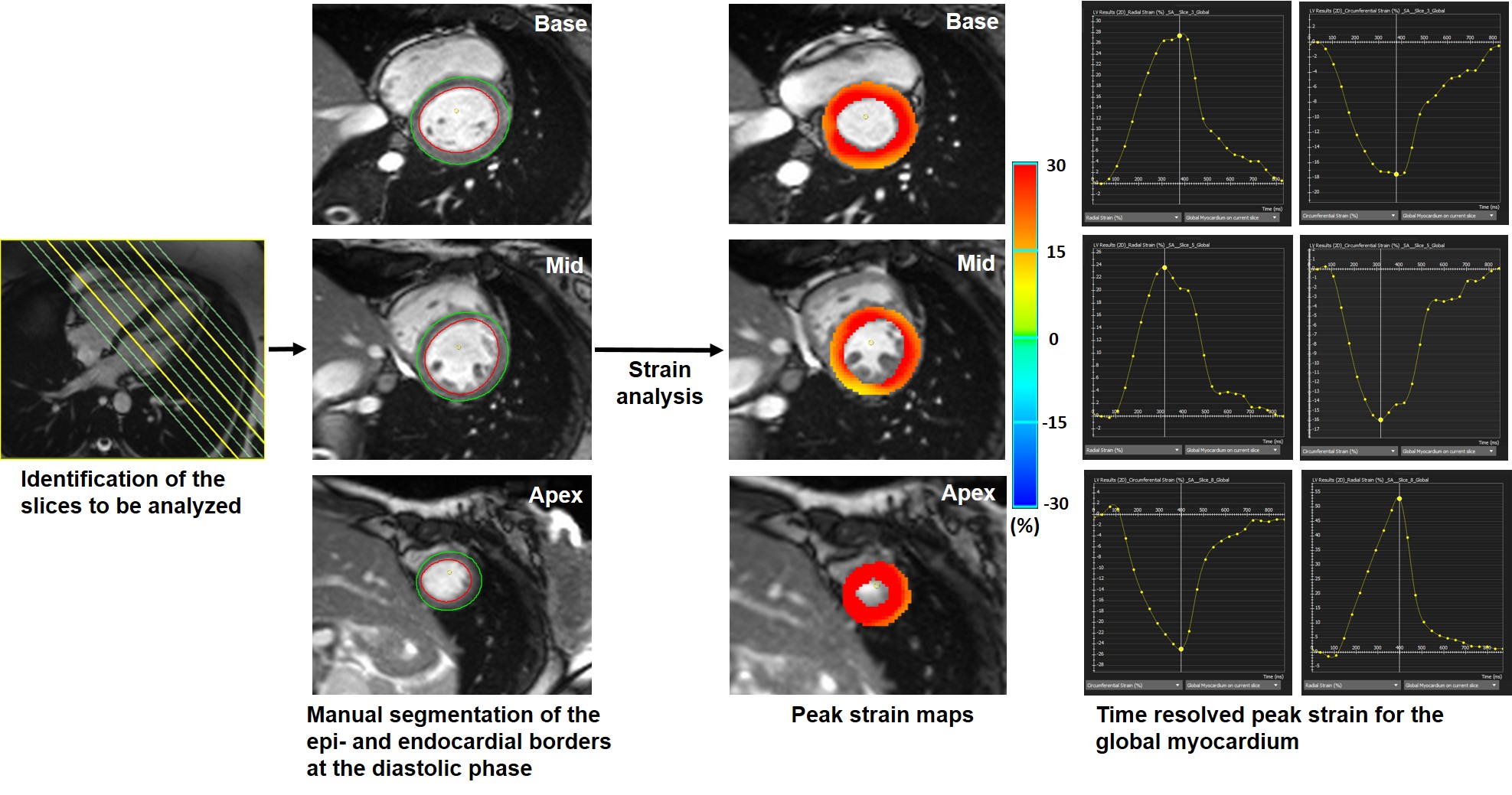 Figure1 Image Analysis Workflow 1408