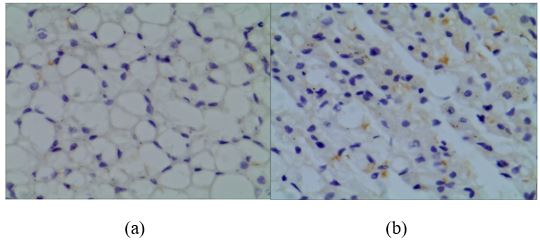 Figure2 (a-b) BATfor Control(a) And (b) Cold Of Scapula Region On ...