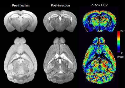 ISMRM20 Power Pitch: High Resolution fMRI