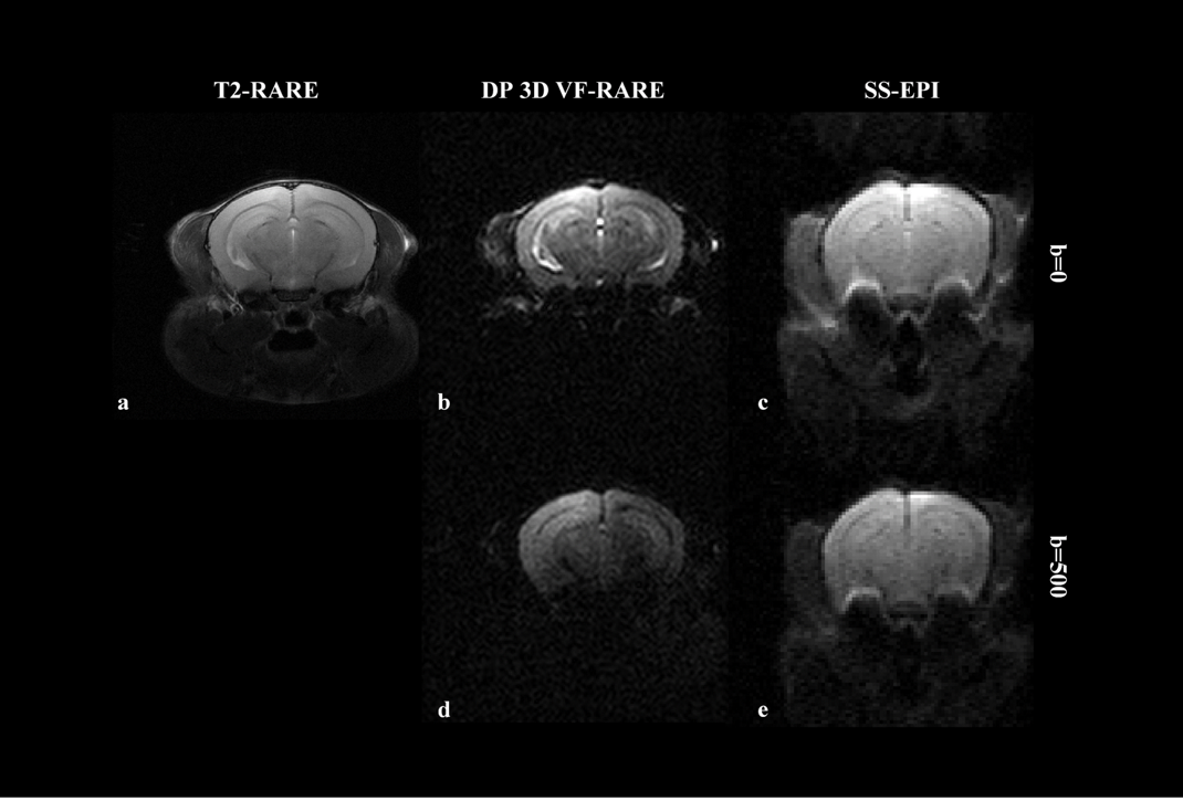 1331 View Abstract View Presentation Distortion Free High Resolution Diffusion Weighted Imaging Of Mouse Brain Using Diffusion Prepared 3d Vf Rare Qiang Liu1 2 Yuanbo Yang1 2 Xinyuan Zhang1 2 Yingjie Mei1 2 3 Qiqi Lu1 2 Guoxi Xie4 And Yanqiu